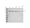 Western blot analysis of CEP135 using anti-CEP135 antibody. Lane 1: human K562 whole cell lysates, Lane 2: human Hela whole cell lysates, Lane 3: human U-87MG whole cell lysates, Lane 4: rat testis tissue lysates, Lane 5: mouse testis tissue lysates. After electrophoresis, proteins were transferred to a nitrocellulose membrane at 150 mA for 50-90 min. Blocked the membrane with 5% non-fat milk/TBS for 1.5 hour at RT.