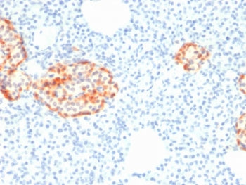 IHC staining of FFPE human pancreas with recombinant Chromogranin A antibody (clone rCHGA/798). HIER: boil tissue sections in pH6, 10mM citrate buffer, for 10-20 min followed by cooling at RT for 20 min.