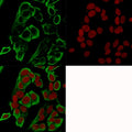 Immunofluorescence testing of human MCF7 cells with recombinant EpCAM antibody (green, clone rMOC-31) and RedDot nuclear stain (red).