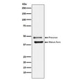 Western blot testing of human HeLa cell lysate with DR5 antibody. Expected molecular weight: ~40 kDa (mature form) and ~48 kDa (precursor). This protein may also be visualized at ~60 kDa.