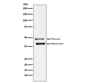 Western blot testing of human HeLa cell lysate with DR5 antibody. Expected molecular weight: ~40 kDa (mature form) and ~48 kDa (precursor). This protein may also be visualized at ~60 kDa.