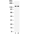 Western blot testing of 1) rat liver and 2) HepG2 lysate with TLR8 antibody. Expected/observed molecular weight ~120 kDa.