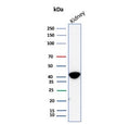 Western blot testing of human kidney tissue lysate with AMACR antibody (clone AMACR/8350R). Predicted molecular weight ~43 kDa.