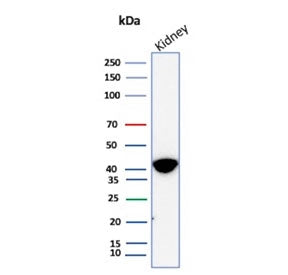 Western blot testing of human kidney tissue lysate with AMACR antibody (clone AMACR/8350R). Predicted molecular weight ~43 kDa.