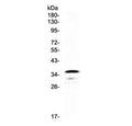 Western blot testing of rat PC-12 cell lysate with CD40 antibody at 0.5ug/ml. Predicted molecular weight is 30-45 kDa depending on glycosylation level.
