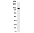 Western blot testing of CSF1R antibody and rat intestine tissue lysate. Predicted molecular weight ~110 kDa.