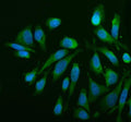 Immunofluorescent staining of MTCH2 using anti-MTCH2 antibody (green). MTCH2 was detected in an immunocytochemical section of HELA cells. Enzyme antigen retrieval was performed using IHC enzyme antigen retrieval reagent for 15 mins. The cells were blocked with 10% goat serum. And then incubated with 5 ug/ml rabbit anti-MTCH2 antibody overnight at 4oC. DyLight 488 Conjugated Goat Anti-Rabbit IgG was used as secondary antibody at 1:500 dilution and incubated for 30 min at 37oC.