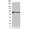 Western blot testing of ALDH2 antibody and rat samples; Lane 1: liver; 2: intestine; 3: lung; 4: kidney tissue lysate. Predicted molecular weight: ~56kDa.