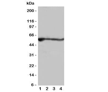 Western blot testing of ALDH2 antibody and rat samples; Lane 1: liver; 2: intestine; 3: lung; 4: kidney tissue lysate. Predicted molecular weight: ~56kDa.