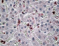 IHC testing of FFPE human liver with CCL20 antibody at 6ug/ml. HIER: steamed with pH6 citrate buffer, AP-staining.