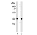 Western blot testing of human 1) Daudi and 2) Raji cell lysate with HLA-DQA1 antibody. Predicted molecular weight ~34 kDa.