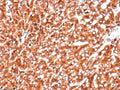 IHC staining of FFPE human pancreas with recombinant Cathepsin D antibody (clone CTSD/9613R). HIER: boil tissue sections in pH 9 10mM Tris with 1mM EDTA for 20 min and allow to cool before testing.