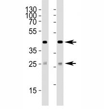 Western blot analysis of lysate from (1) 293 and (2) HepG2 cell line using SIRT3 antibody at 1:1000. Predicted size: 44/28 kDa (full/processed)