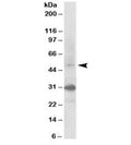 Western blot testing of human kidney lysate with FBXW2 antibody at 0.3ug/ml. Predicted molecular weight: ~51kDa. Both observed bands were blocked by addition of the immunzing peptide.