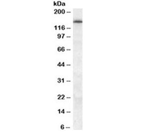 Western blot testing of human frontal cortex lysate with ABCC5 antibody at 0.5ug/ml. Predicted molecular weight: isoforms mayb be observed at ~23 kDa and 155-160 kDa.