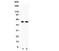 Western blot testing of PIASg antibody and Lane 1: human placenta; 2: A431 lysate. Expected/observed size ~56 kDa.