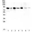 Western blot testing of human 1) U-87MG, 2) U-2 OS, 3) HeLa, 4) 22RV1, 5) K562, 6) rat liver and 7) mouse thymus lysate with MED15 antibody at 0.5ug/ml. Predicted molecular weight ~87 kDa.