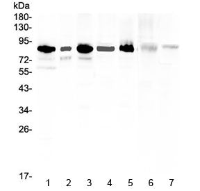 Western blot testing of human 1) U-87MG, 2) U-2 OS, 3) HeLa, 4) 22RV1, 5) K562, 6) rat liver and 7) mouse thymus lysate with MED15 antibody at 0.5ug/ml. Predicted molecular weight ~87 kDa.