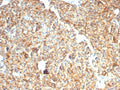 IHC staining of FFPE dog liver with EpCAM / CD326 antibody (clone rEGP40/7334). HIER: boil tissue sections in pH 9 10mM Tris with 1mM EDTA for 20 min and allow to cool before testing.