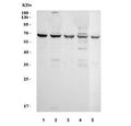Western blot testing of 1) human SW620, 2) human COLO-320, 3) human ThP-1, 4) human K562 and 5) mouse ANA-1 cell lysate with TNFRSF1B antibody. Predicted molecular weight: 50~80 kDa depending on glycosylation level.