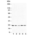 Western blot testing of FGF10 antibody and Lane 1: U87; 2: HeLa; 3: A549; 4: 293T; 5: HeLa cell lysate. Predicted molecular weight ~23 kDa.