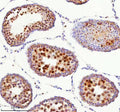 Immunohistochemical staining of BCCIP using anti-BCCIP antibody. BCCIP was detected in a paraffin-embedded section of mouse testis tissue. Heat mediated antigen retrieval was performed in EDTA buffer (pH 8.0, epitope retrieval solution). The tissue section was blocked with 10% goat serum. The tissue section was then incubated with 2 ug/ml rabbit anti-BCCIP antibody overnight at 4oC. Peroxidase Conjugated Goat Anti-rabbit IgG was used as secondary antibody and incubated for 30 min at 37oC.