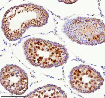 Immunohistochemical staining of BCCIP using anti-BCCIP antibody. BCCIP was detected in a paraffin-embedded section of mouse testis tissue. Heat mediated antigen retrieval was performed in EDTA buffer (pH 8.0, epitope retrieval solution). The tissue section was blocked with 10% goat serum. The tissue section was then incubated with 2 ug/ml rabbit anti-BCCIP antibody overnight at 4oC. Peroxidase Conjugated Goat Anti-rabbit IgG was used as secondary antibody and incubated for 30 min at 37oC.