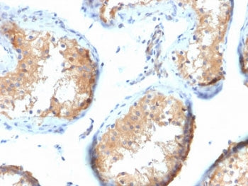 IHC testing of FFPE human testis tissue with Vinculin antibody (clone VCL/2573). HIER: boil tissue sections in pH6, 10mM citrate buffer, for 10-20 min followed by cooling at RT for 20 min.
