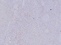 IHC staining of FFPE human tonsil tissue with FOXP3 antibody (clone FOXP3/8277R). HIER: boil tissue sections in pH 9 10mM Tris with 1mM EDTA for 20 min and allow to cool before testing.