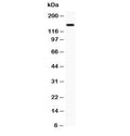 Western blot testing of P-Selectin antibody and PANC lysate; The protein is visualized from 86~140 kDa due to glycosylation.