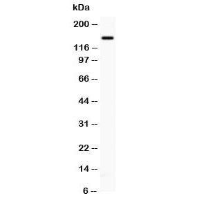 Western blot testing of P-Selectin antibody and PANC lysate; The protein is visualized from 86~140 kDa due to glycosylation.