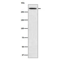 Western blot testing with SPTA1 antibody. Expected molecular weight: 260-280 kDa.