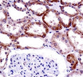 CD70 antibody immunohistochemistry analysis in formalin fixed and paraffin embedded human kidney tissue.
