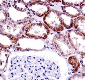 CD70 antibody immunohistochemistry analysis in formalin fixed and paraffin embedded human kidney tissue.