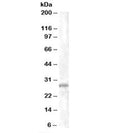 Western blot testing of K562 lysate with CHMP5 antibody at 1ug/ml. Predicted molecular weight: ~25kDa.