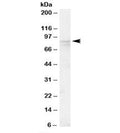 Western blot testing of human placenta lysate with OSBP antibody at 0.1ug/ml. Predicted molecular weight: ~89kDa.