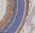Immunohistochemical staining of GRK1 using anti-GRK1 antibody. GRK1 was detected in a paraffin-embedded section of mouse eye tissue. Heat mediated antigen retrieval was performed in EDTA buffer (pH 8.0, epitope retrieval solution). The tissue section was blocked with 10% goat serum. The tissue section was then incubated with 2 ug/ml rabbit anti-GRK1 antibody overnight at 4oC. Peroxidase Conjugated Goat Anti-rabbit IgG was used as secondary antibody and incubated for 30 min at 37oC.