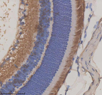 Immunohistochemical staining of GRK1 using anti-GRK1 antibody. GRK1 was detected in a paraffin-embedded section of mouse eye tissue. Heat mediated antigen retrieval was performed in EDTA buffer (pH 8.0, epitope retrieval solution). The tissue section was blocked with 10% goat serum. The tissue section was then incubated with 2 ug/ml rabbit anti-GRK1 antibody overnight at 4oC. Peroxidase Conjugated Goat Anti-rabbit IgG was used as secondary antibody and incubated for 30 min at 37oC.