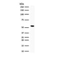 Western blot testing of human Jurkat cell lysate with TOP1MT antibody (clone TPIMT-1). Predicted molecular weight ~66 kDa.