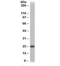 Western blot testing of HeLa lysate with TMS1 antibody at 1ug/ml. Predicted molecular weight ~22 kDa.