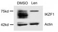 Western blot testing of lysate from multiple myeloma cells treated with DMSO (vehicle) or lenalidomide (degrades IKAROS). Predicted molecular weight ~58 kDa.