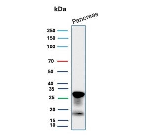 Western blot testing of human pancreas tissue lysate with Elastase 3A antibody (clone CELA3A/12552). Predicted molecular weight ~29 kDa.
