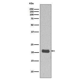Western blot testing of human MCF7 cell lysate with HRAS antibody. Predicted molecular weight ~21 kDa.