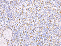 IHC staining of FFPE human spleen tissue with CD163 antibody at 1ug/ml. Required HIER: steam section in pH8 EDTA for 20 min and allow to cool prior to staining.