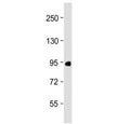 Western blot testing of human placenta lysate with Factor XIIIa antibody at 1:2000. Predicted molecular weight ~83 kDa.