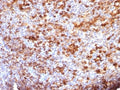 IHC: Formalin-fixed, paraffin-embedded human tonsil stained with anti-IgG antibody (B33/20)