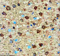Immunohistochemical staining of SMARCAL1 using anti-SMARCAL1 antibody. SMARCAL1 was detected in a paraffin-embedded section of mouse brain tissue. Heat mediated antigen retrieval was performed in EDTA buffer (pH 8.0, epitope retrieval solution). The tissue section was blocked with 10% goat serum. The tissue section was then incubated with 2 ug/ml rabbit anti-SMARCAL1 antibody overnight at 4oC. Peroxidase Conjugated Goat Anti-rabbit IgG was used as secondary antibody and incubated for 30 min at 37oC.