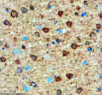Immunohistochemical staining of SMARCAL1 using anti-SMARCAL1 antibody. SMARCAL1 was detected in a paraffin-embedded section of mouse brain tissue. Heat mediated antigen retrieval was performed in EDTA buffer (pH 8.0, epitope retrieval solution). The tissue section was blocked with 10% goat serum. The tissue section was then incubated with 2 ug/ml rabbit anti-SMARCAL1 antibody overnight at 4oC. Peroxidase Conjugated Goat Anti-rabbit IgG was used as secondary antibody and incubated for 30 min at 37oC.