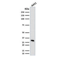 Western blot testing of human A431 cell lysate with MTAP antibody (clone MTAP/1813). Expected molecular weight: 26-38 kDa (multiple isoforms).