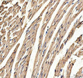 IHC staining of FFPE mouse heart tissue with Myoglobin antibody. HIER: boil tissue sections in pH8 EDTA for 20 min and allow to cool before testing.